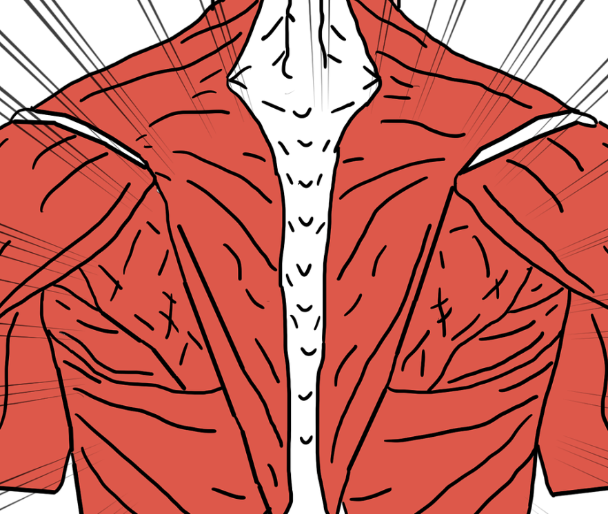 Fibromyalgie