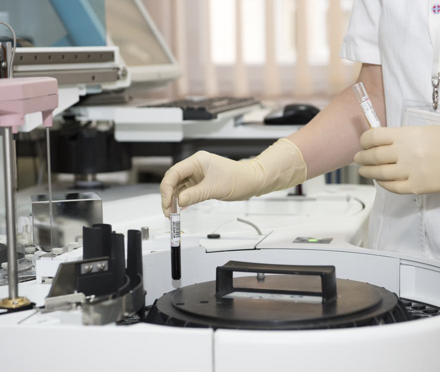 Onderzoek ontstekingsreuma